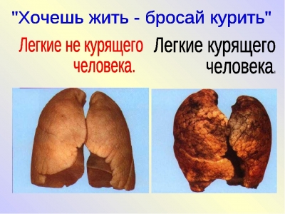 5 ШАГОВ, ЧТОБЫ БРОСИТЬ КУРИТЬ
