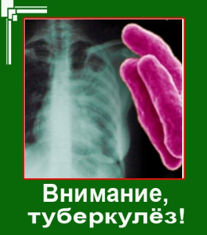 ВНИМАНИЕ, ТУБЕРКУЛЕЗ!